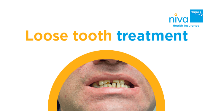 loose tooth treatment
