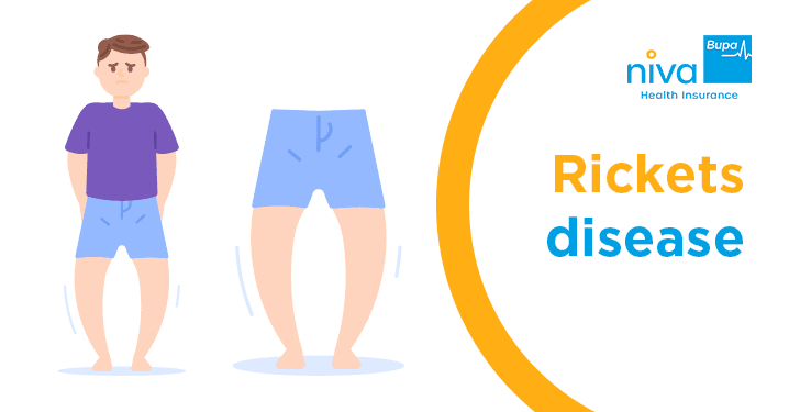 rickets disease