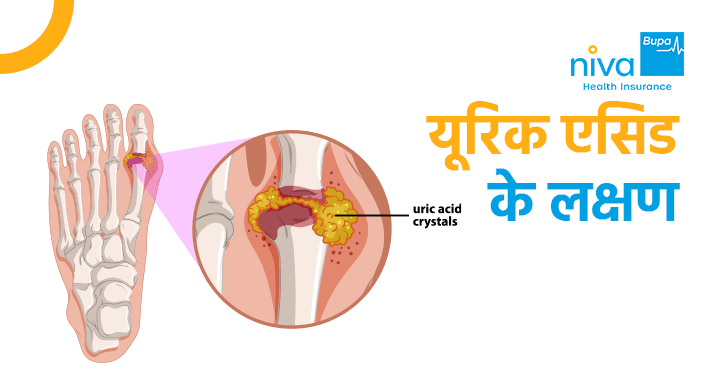 Uric Acid Symptoms in Hindi