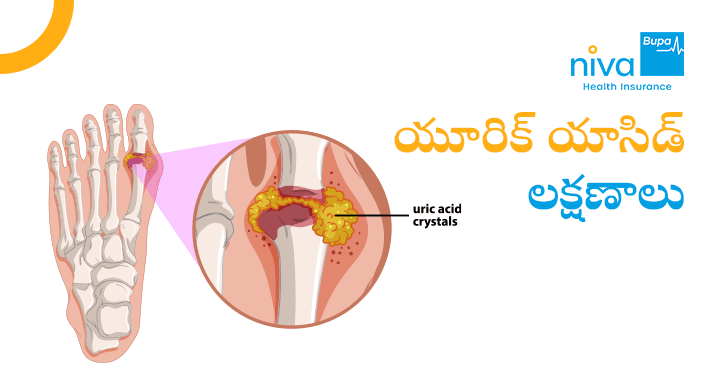 Uric Acid Symptoms in Telugu