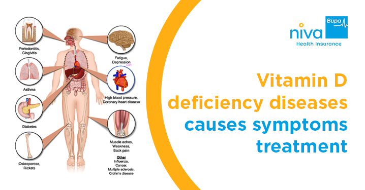 Vitamin D Deficiency Diseases