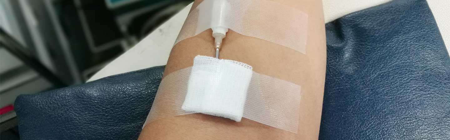 VDRL Test: Purpose, Procedure & Normal Results Explained